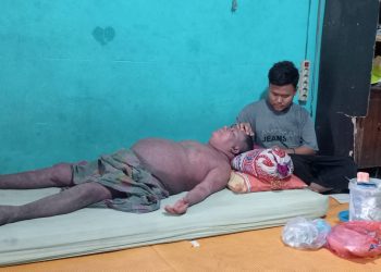 Pak Kapolres, Bupati Asahan dan Para Dermawan Tolong Bantuannya, Akibat Sakit Kulit Mata Zainal Abidin Buta