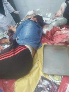 korban yang dibacok suaminya saat mendapatkan perawatan medis di rsu.