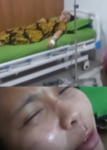 Wanita Ini Ngaku Dianiaya Istri Oknum Personel Polda Sumut