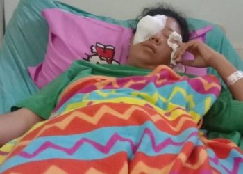 Wanita Ini Jadi Korban Pelemparan Pakai Batu, Pelaku Ditangkap Polisi