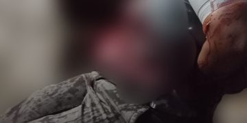 Ditikam Tetangga 3 Liang, IRT di Tebingtinggi Tewas